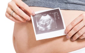 A partir du 1er mai, une justification médicale sera exigée pour le remboursement des césariennes