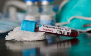 Nouveau cas de coronavirus à Marrakech