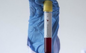 Deux nouveaux cas d'infection au Covid-19