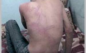 Le CNDH se saisit de l’affaire : Un étudiant torturé à la préfecture de police de Fès