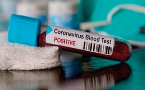 ​Des chiffres en furie : Le Covid se déchaîne