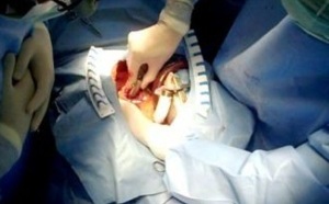 Suite au décès d’une jeune fille opérée du cœur : Sit-in devant une clinique à Rabat