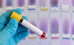 SOS: Le variant britannique s’invite chez-nous