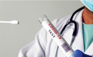 Les tests antigéniques, un précieux allié contre la propagation du Sars-Cov-2