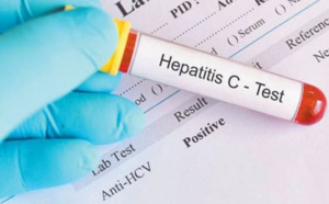 Première enquête nationale de séroprévalence au Maroc