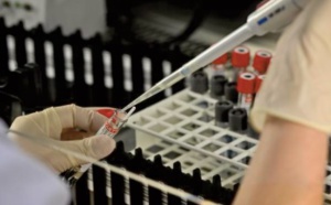 Le virus fait le singe