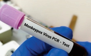 Les trois cas suspects de variole de singe détectés au Maroc sont négatifs