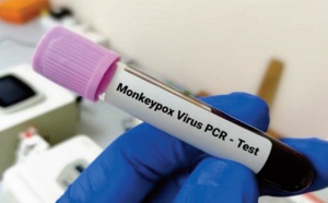 Elaboration d’un plan de quatre phases contre la variole du singe
