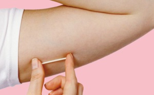 Un implant contraceptif pour limiter les naissances
