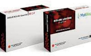 Moldiag, spin-off de la Fondation MAScIR de UM6P, lance le premier test 100% marocain de diagnostic de la leucémie