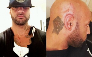 Booba blessé au crâne par Dam16