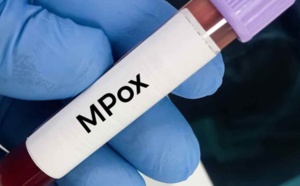 La variole du singe inquiète de par le monde. Le Maroc intensifie sa vigilance: S.O.S MPOX