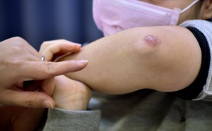 "Kumitaiso", des milliers d'enfants japonais aux urgences