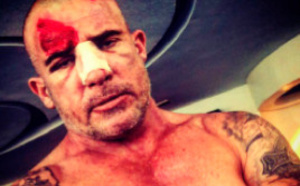 Dominic Purcell sévèrement  blessé sur le tournage de Prison Break au Maroc 
