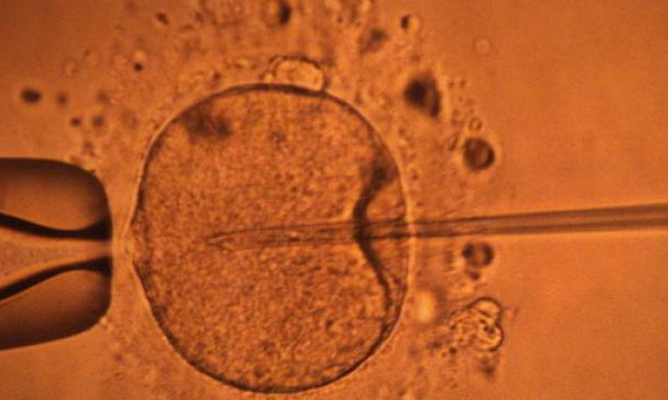 Des ovules créés en laboratoire à partir de cellules souches