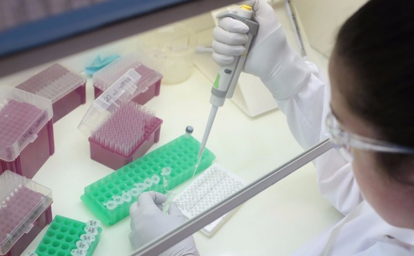 Des virus plus cléments avec les femmes qu'avec les hommes