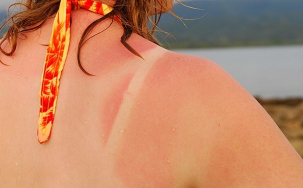 Découverte d'une substance pour bronzer sans être au soleil