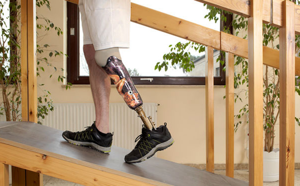Une imprimante  3D pour fabriquer les prothèses de Handicap international