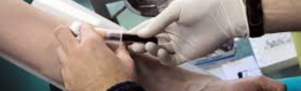 Test sanguin pour détecter tôt un cancer du pancréas
