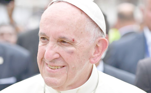 Insolite : ​Blessure du pape