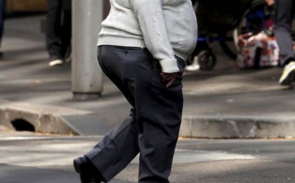 L'excès de poids lié à près de 40% aux cancers aux Etats-Unis