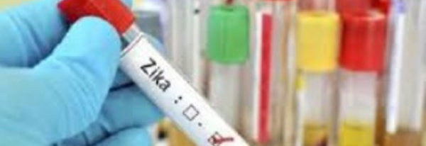 Un cocktail d'anticorps bloque le virus Zika chez des singes