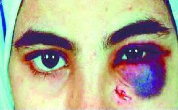 La violence contre les femmes dénoncée par des victimes : La parole libérée