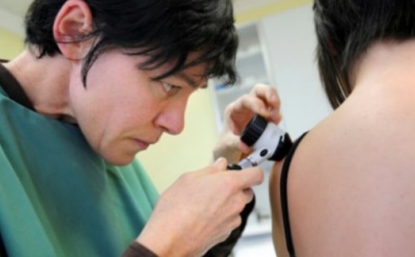Un ordinateur meilleur que les dermatologues pour repérer les cancers