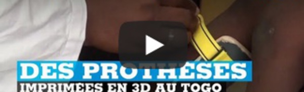 Des prothèses imprimées en 3D au Togo