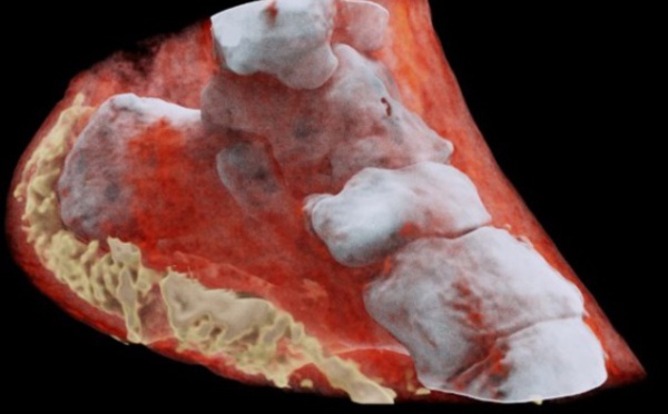 Première radiographie couleur 3D d'un humain