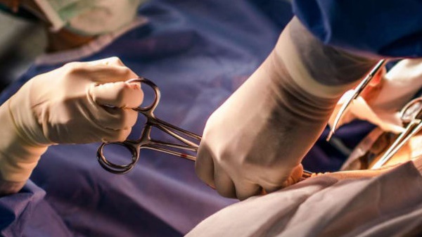 La césarienne cinquante fois plus mortelle pour les femmes africaines