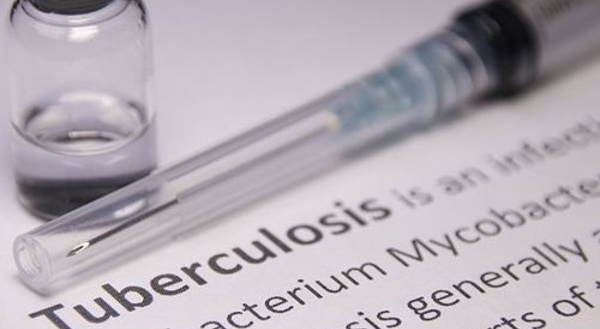 Possibilité d’éradiquer la tuberculose en 25 ans