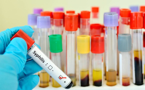 La syphilis regagne du terrain