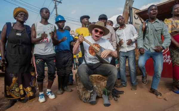Au Malawi, un "fils" de Salif Keita au service de la cause albinos
