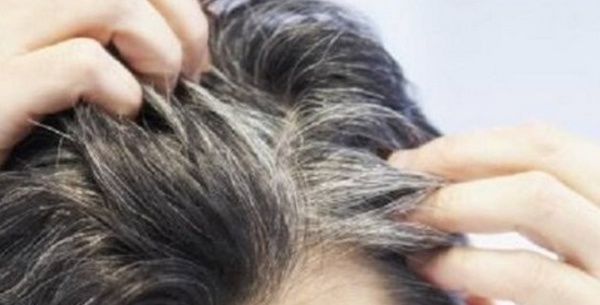 Pourquoi le stress favorise l'apparition de cheveux blancs