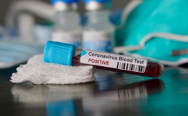 Nouveau cas de coronavirus à Marrakech