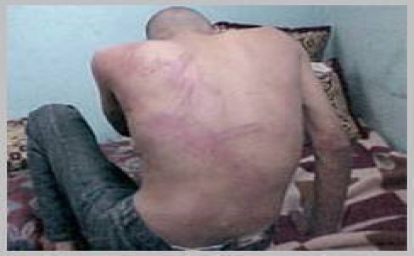 Le CNDH se saisit de l’affaire : Un étudiant torturé à la préfecture de police de Fès