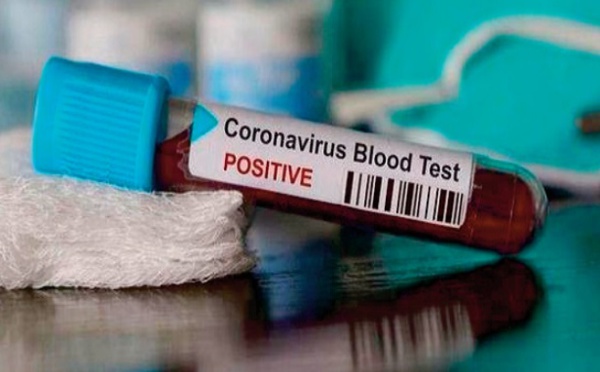 ​Des chiffres en furie : Le Covid se déchaîne