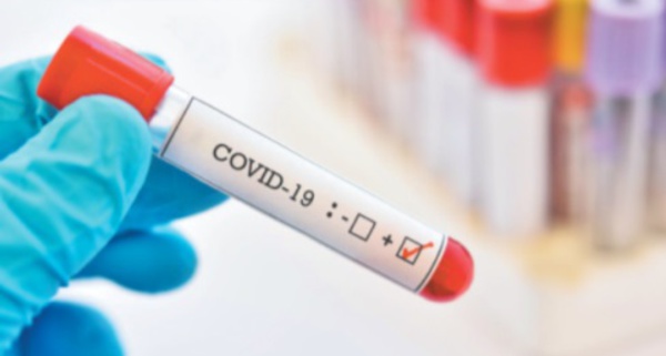 ​Recrudescence : Et si on en dénombrait les causes ?