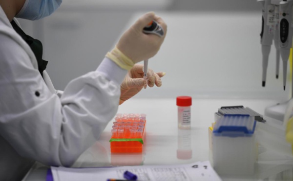 Qu’on se le dise ! Le test sérologique vient en complément du PCR