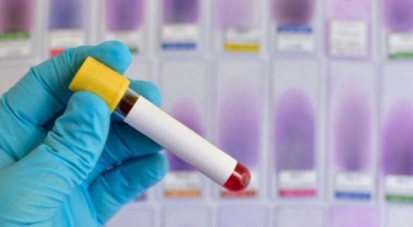 SOS: Le variant britannique s’invite chez-nous