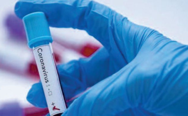 La propagation de l’épidémie inquiète le ministère de la Santé