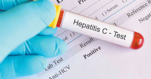 Première enquête nationale de séroprévalence au Maroc