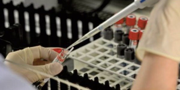 Le virus fait le singe