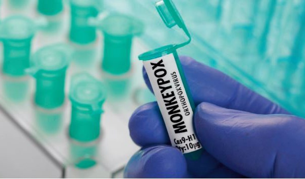 Pas de quoi fouetter un singe