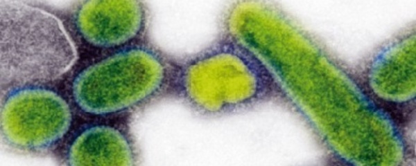 Des chercheurs trouvent l’origine de la grippe espagnole