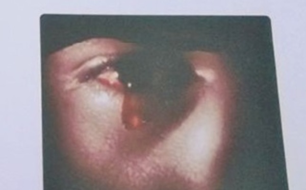 “Larmes de sang” de Khatiba Moundib