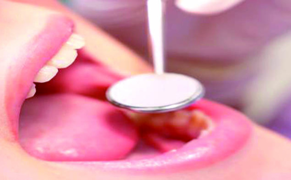 Une bonne santé est tributaire  de l’hygiène bucco-dentaire