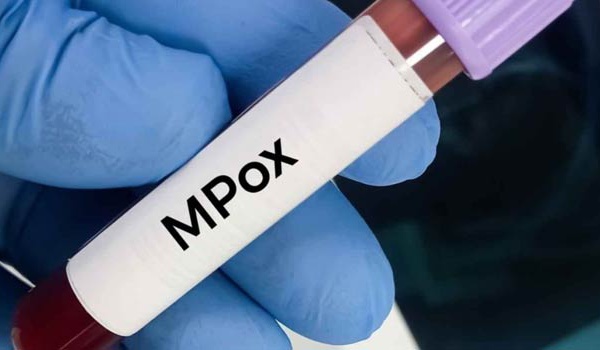 La variole du singe inquiète de par le monde. Le Maroc intensifie sa vigilance: S.O.S MPOX
