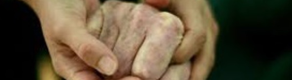 Alzheimer: la découverte de mycoses relance la piste infectieuse